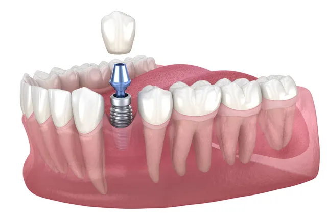 iStock-1269231019-a165d740-640w